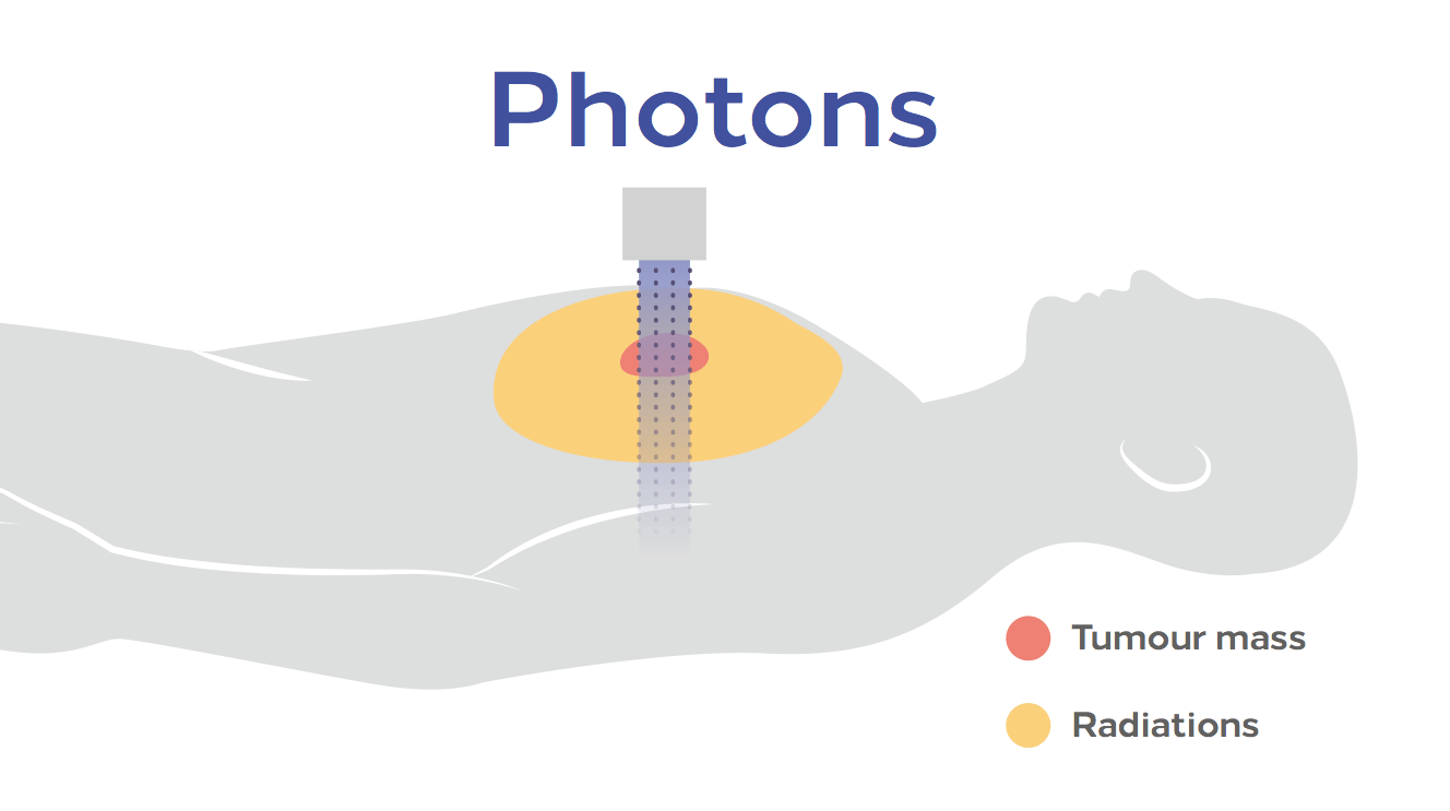 protonterapia